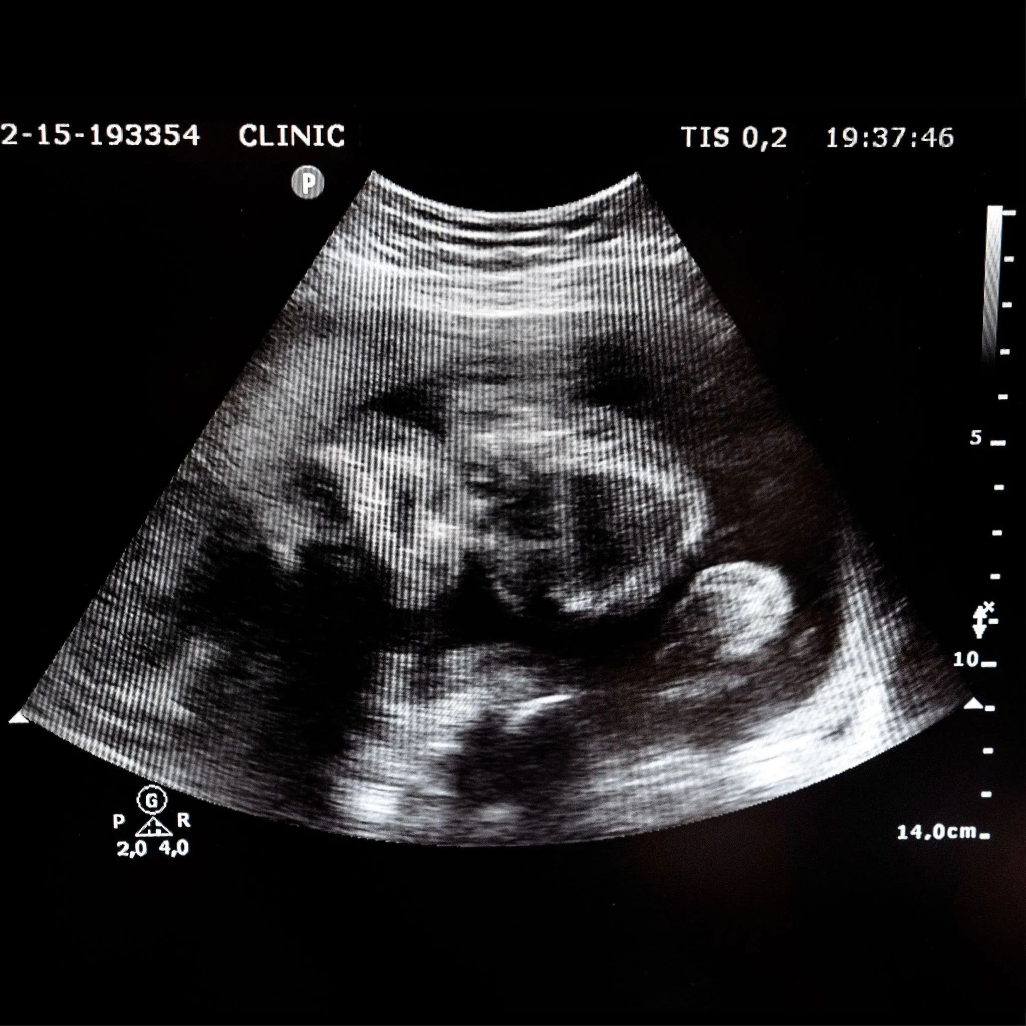 AR-33-bebe-C2.jpg